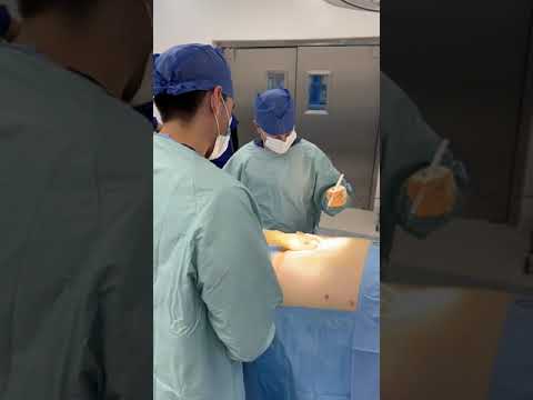 Surgical Procedures part 1 | Dr. Jorge Maytorena, Bariatric Surgeon