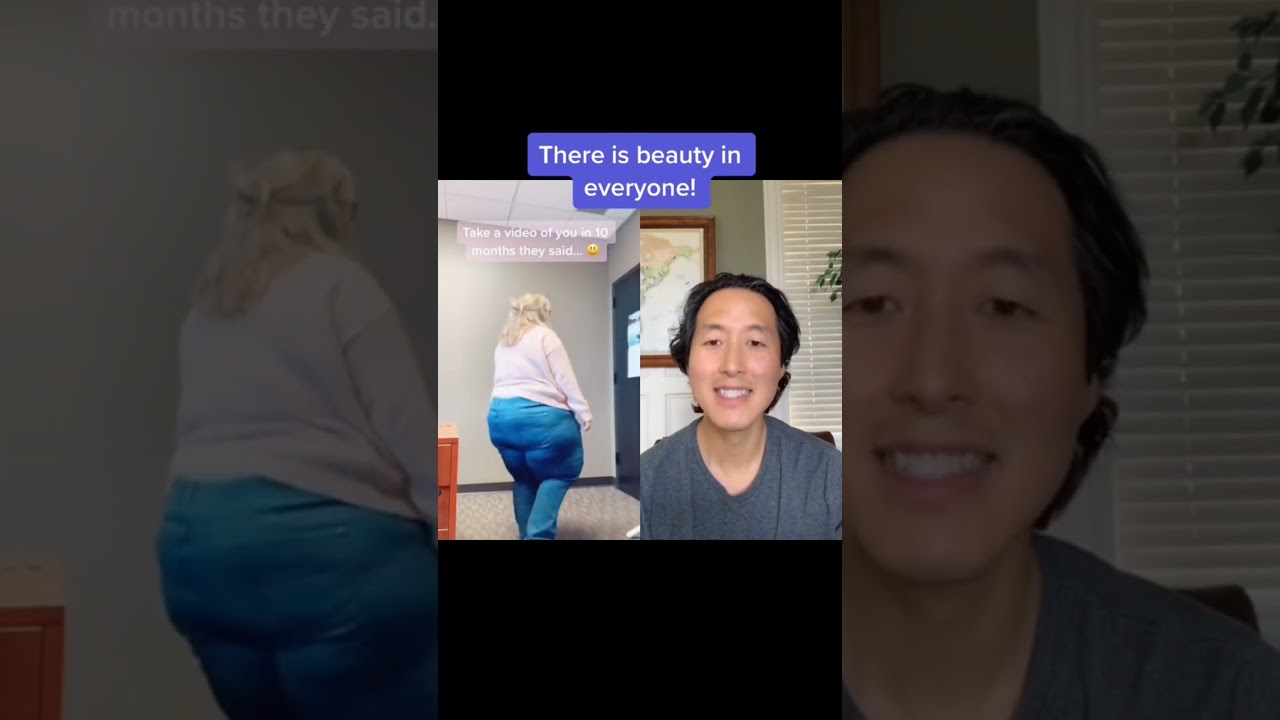 Incredible Weight Loss Journey! #shorts #weightloss