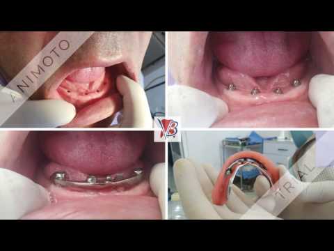 VB Dental Clinic (Dental Tourism), Yerevan, Armenia 1080p HD