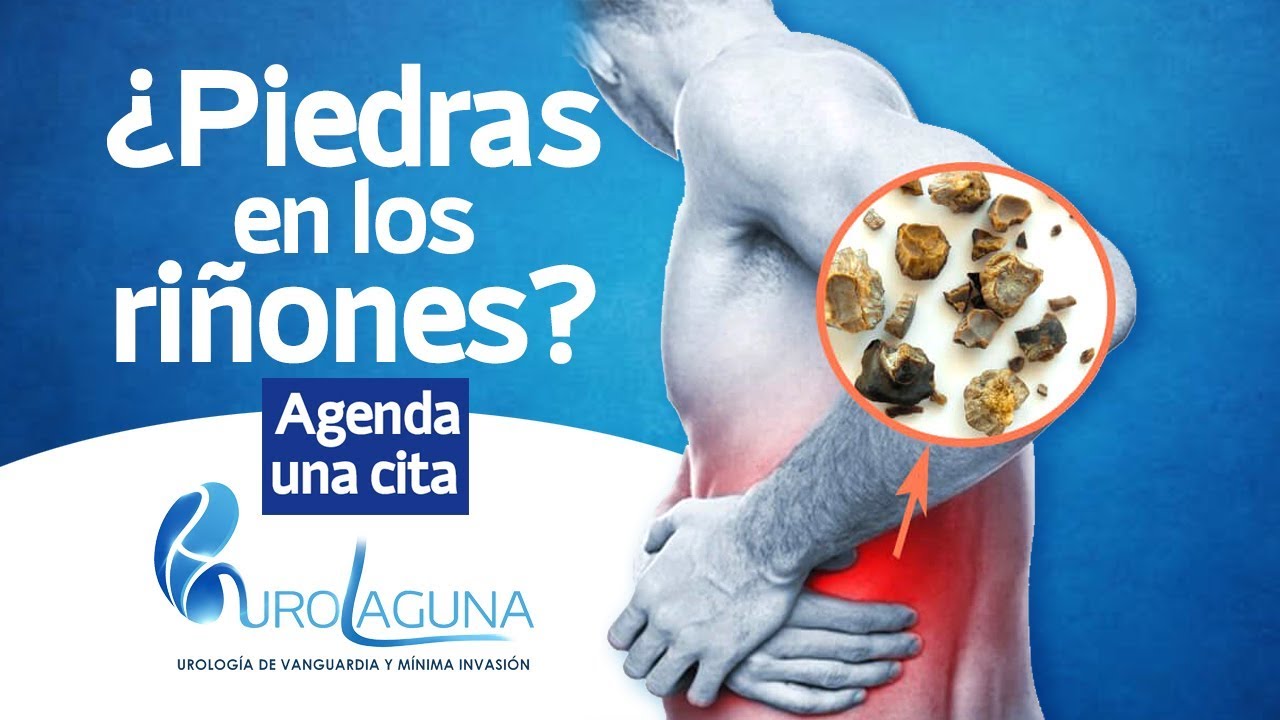 Héctor Iván Martínez López-31