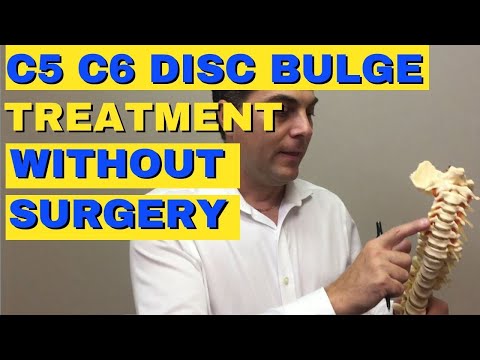 C5 C6 Disc Bulge Treatment Without Surgery | Bulging Disc C5 C6 |  Dr. Walter Salubro
