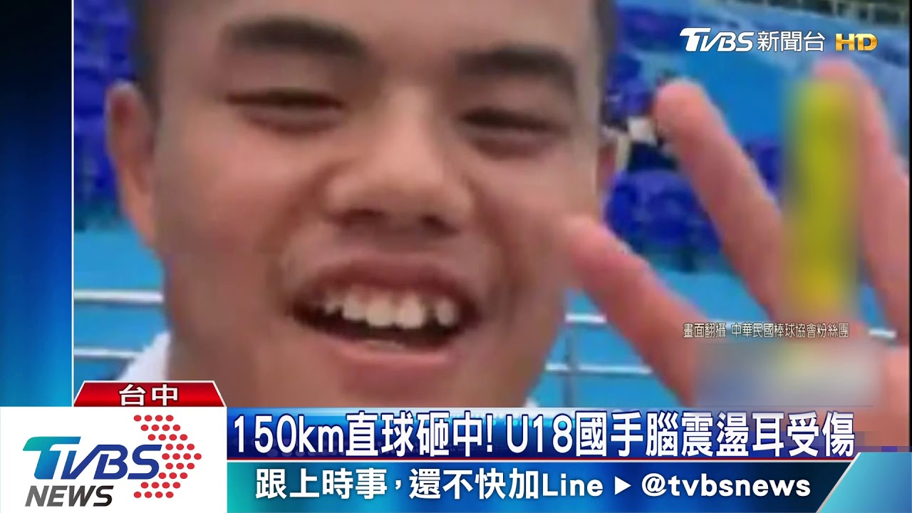 150km直球砸中! U18國手腦震盪耳受傷