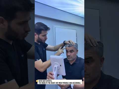 Hair loss shouldn’t overshadow your confidence. With TurchCare, feel like yourself again! #turchcare