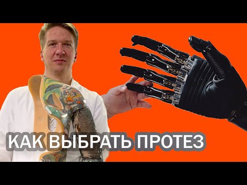Протезист Антон Круглов - о выборе протеза и проблемах протезирования в России