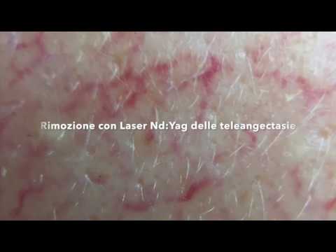 La decolorazione di pacco di faccia e linumidimento Le maschere da pigmentary notano su risposte di faccia