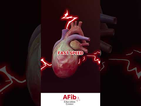 AFib or Something Else? Decoding Your Heart's Irregular Rhythm