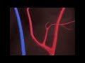 Brain Fart Meme Slowed High Pitch