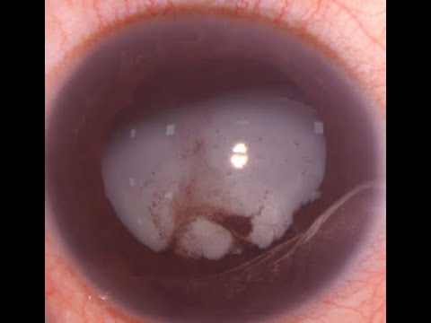 Retina Institute Kashi-Admin