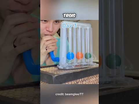 Appareil médical incroyable....#shortsviral #viral