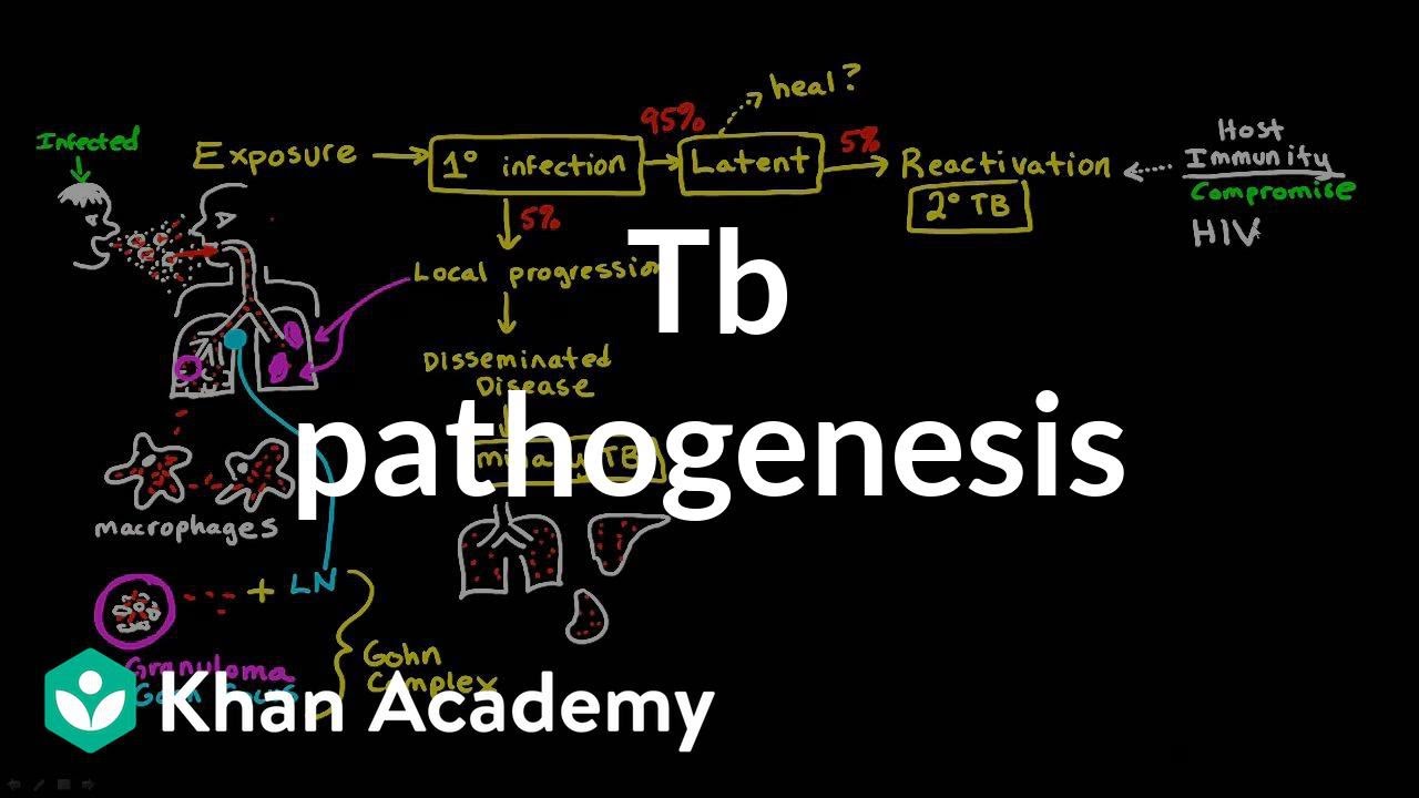 TB pathogenesis | Infectious diseases | NCLEX-RN | Khan Academy