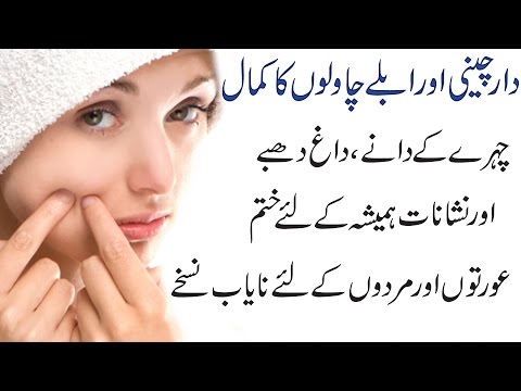 Secrets to Remove Pimples, Dark Spots, Acne Holes & Scars Overnight Complete Treatment in Urdu Hindi Video