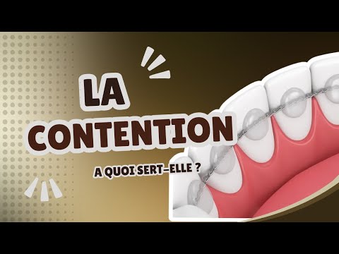 Comprendre la contention orthodontique