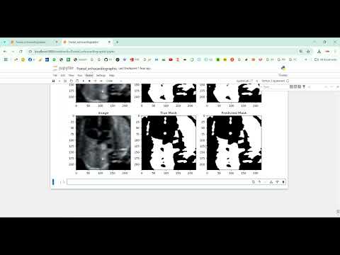 Foetal Segmentation using Image in Python Projects