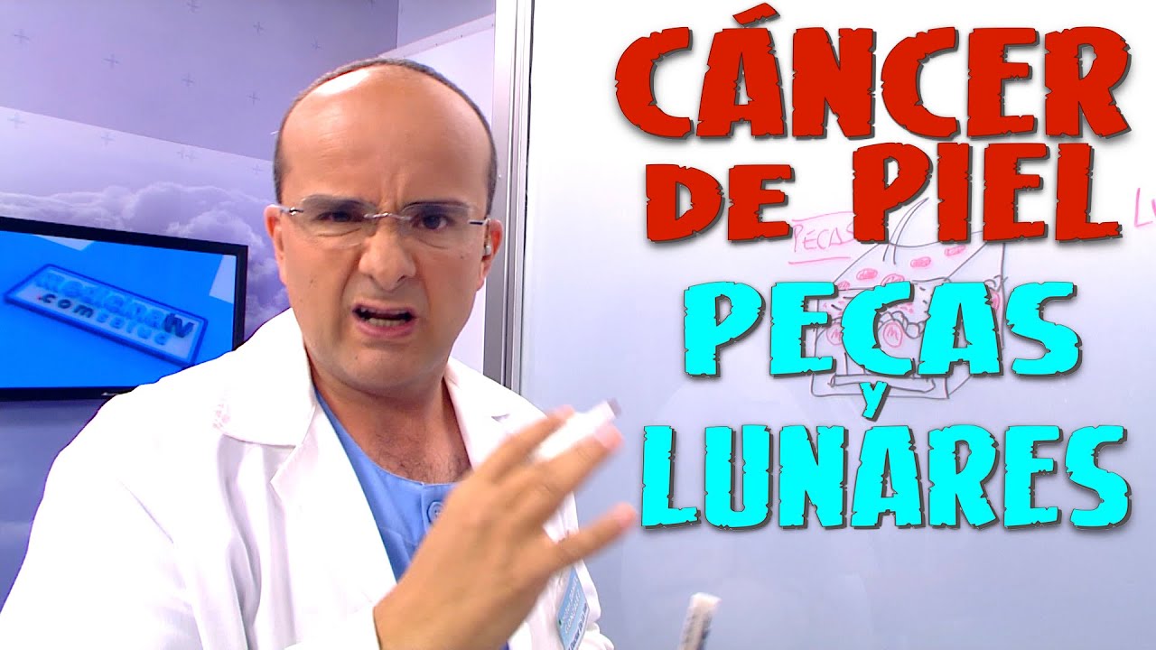 CÁNCER DE PIEL, PECAS y LUNARES ¿Alguna relación ¿Aumenta el Riesgo - Cáncer #24