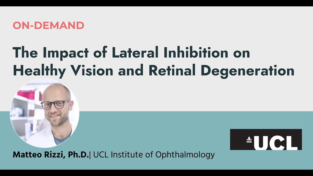 Journal Club | The Impact of Lateral Inhibition on Healthy Vision and Retinal Degeneration