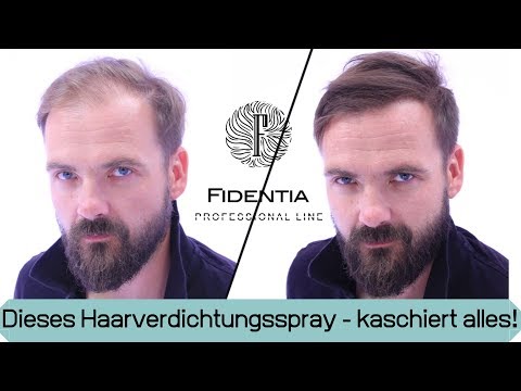 Wieder volles Haar ohne Haarsystem | Transformation mit Mane Haarauffüller Spray