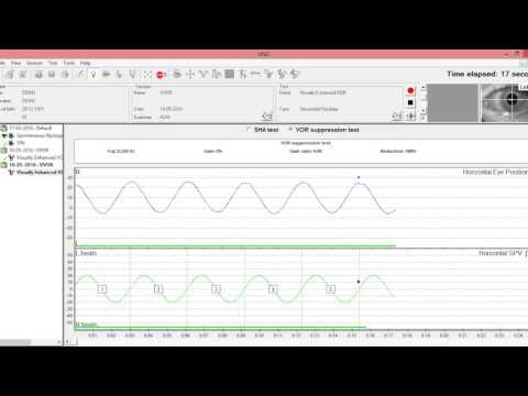 Visually Enhanced VOR (VVOR)