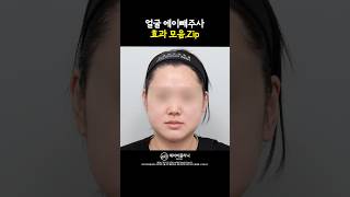 이중턱이랑 작별한 에이빼 전후 모음.ZIP