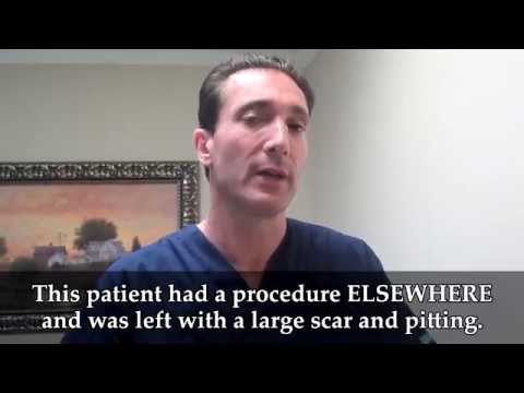 Marc's Surgery