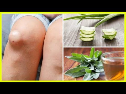 Gelenkschmerzen nach Prothese Gelenkschmerzen und geschwollene Finger