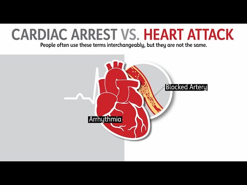 Heart Attack vs Cardiac Arrest