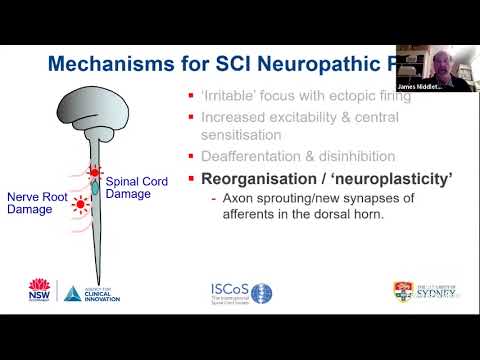 Middleton J. - SCI-induced pain: overactivity, imbalance, and reorganization mechanisms