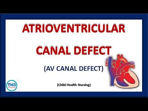 AV CANAL DEFECT | ATRIOVENTRICULAR CANAL DEFECT | Congenital Heart Disease | The Nurses Station
