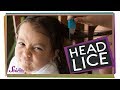 Where Do Lice Come From?