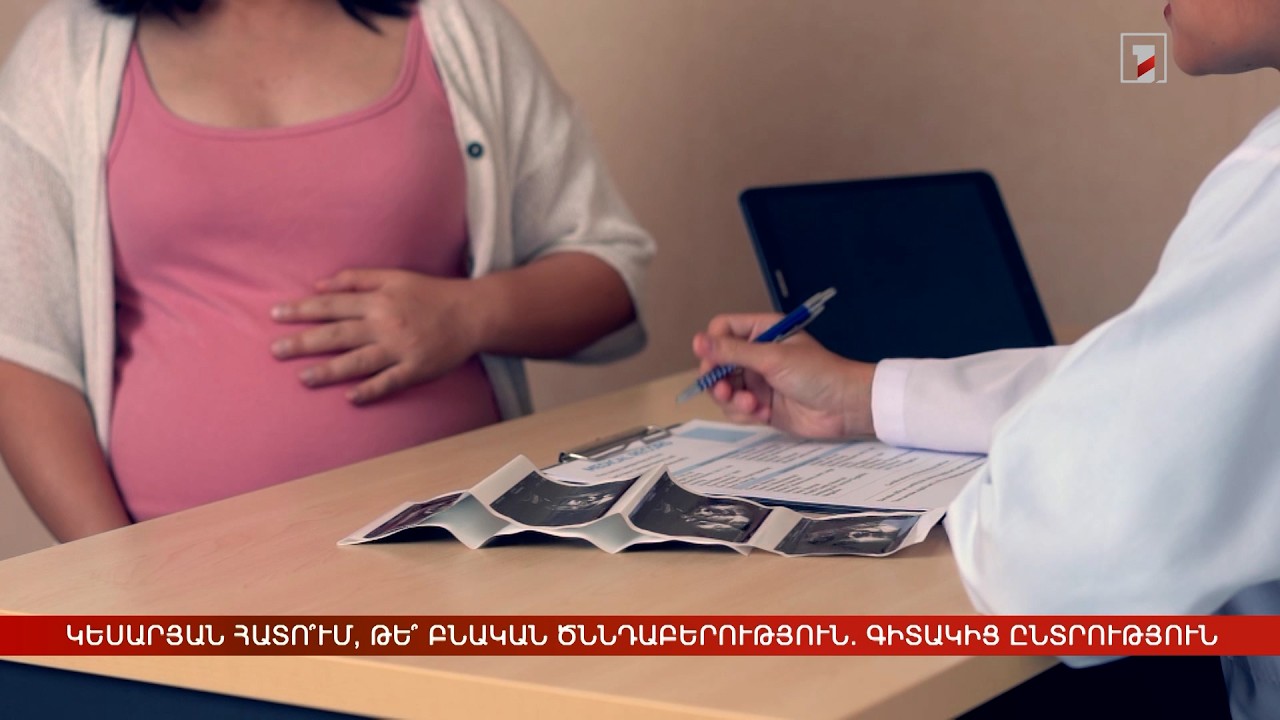 Կեսարյան հատո՞ւմ, թե՞ բնական ծննդաբերություն. գիտակից ընտրություն