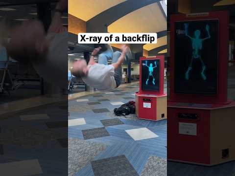 BACKFLIP IN HOSPITAL 🏥