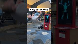 BACKFLIP IN HOSPITAL 🏥