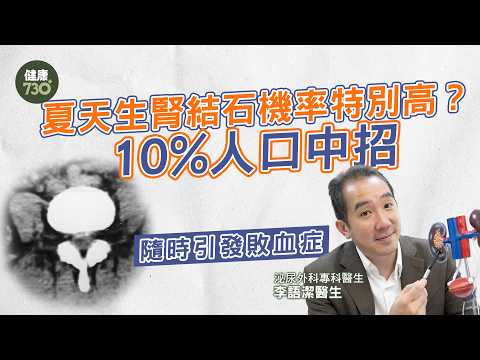 腎結石成因＋治療懶人包｜飲啤酒可以排水防腎石？腎石痛在哪裏？大過5mm點算？醫生一次講清楚！