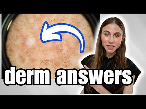 Dermatologist Answers Skincare Questions | Sun Spots, Tretinoin, KP & More