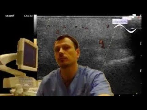 Pediatric Soft tissue ultrasound - Cheek edema