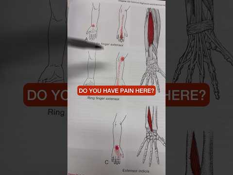 How to Repair and Relieve Forearm pain Forever! #shorts