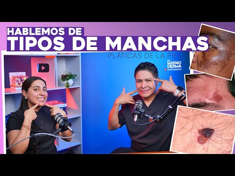 LET'S TALK ABOUT TYPES OF SPOTS. Skin Talks