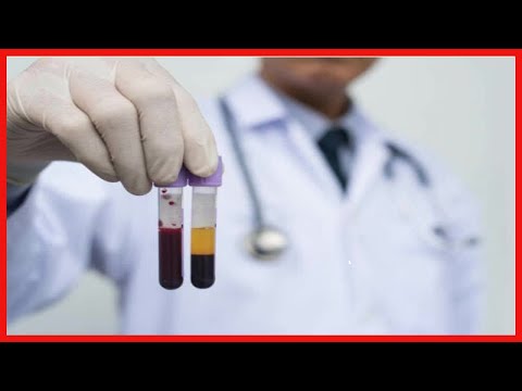 Blutplasmatransfusion: Ablauf, Arten und Risiken