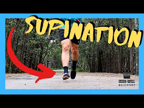 Running with Supination | How I overcame Supination of the foot and IT Band Syndrome!