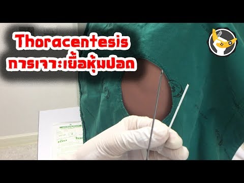 ฉีดในโรคสะเก็ดเงิน อาการคันโรคภูมิแพ้ทั่วร่างกายในโรคสะเก็ดเงิน