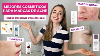 MEJORES COSMÉTICOS PARA MARCAS DE ACNÉ / CÓMO ELIMINAR MANCHAS DE ACNÉ EN CASA | SEPTIEMBRE 2021