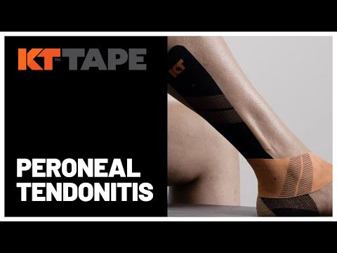 KT Tape - Peroneal Tendonitis