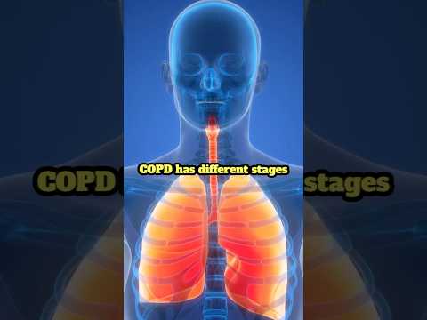 COPD stages explained #copd #lungdisease #pulmonaryrehabilitation