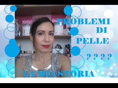 Carbone e psoriasi Ksimedon e psoriasi