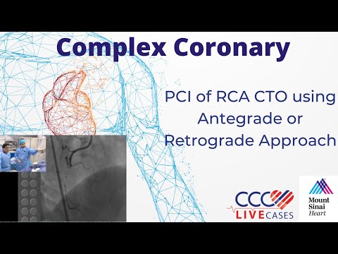 PCI of RCA CTO using Antegrade or Retrograde Approach - July 17, 2018