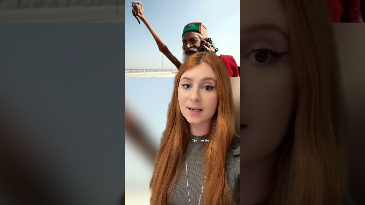 Esse homem não ABAIXA SEU BRAÇO há mais de 40 ANOS #shorts