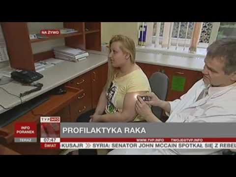 Koślawe ustawienie kolan przystanek Guzki na leczeniu palce jodu