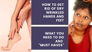 HOW TO GET RID OF DRY WRINKLED HANDS AND FEET/CLEAR DARK HAND FEET #wrinkles