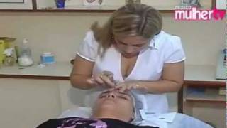 Benefícios da Acupuntura Estética - beleza e equilíbrio