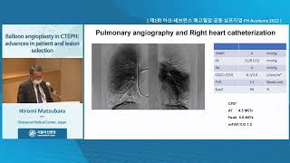 제2회 아산·세브란스 폐<b>고혈압</b> 공동 심포지엄 PH Academy 2022 : Balloon angioplasty in CTEPH: advances in patient and lesion selection 미리보기 썸네일