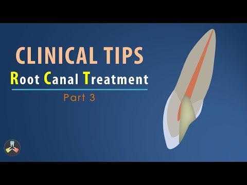 Root Canal Treatment | Clinical Tips | Part 3